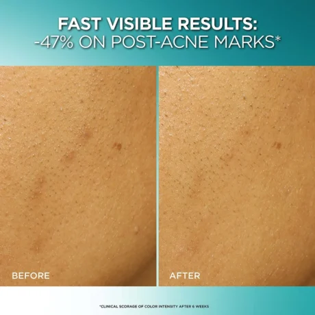 Dark Spot Exfoliant Peel2