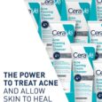 Acne Foaming Cream Cleansers