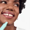 Acne Solutions™ Emergency Touch Sticks