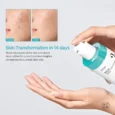 BHA 2% Gentle Exfoliating Tonerss