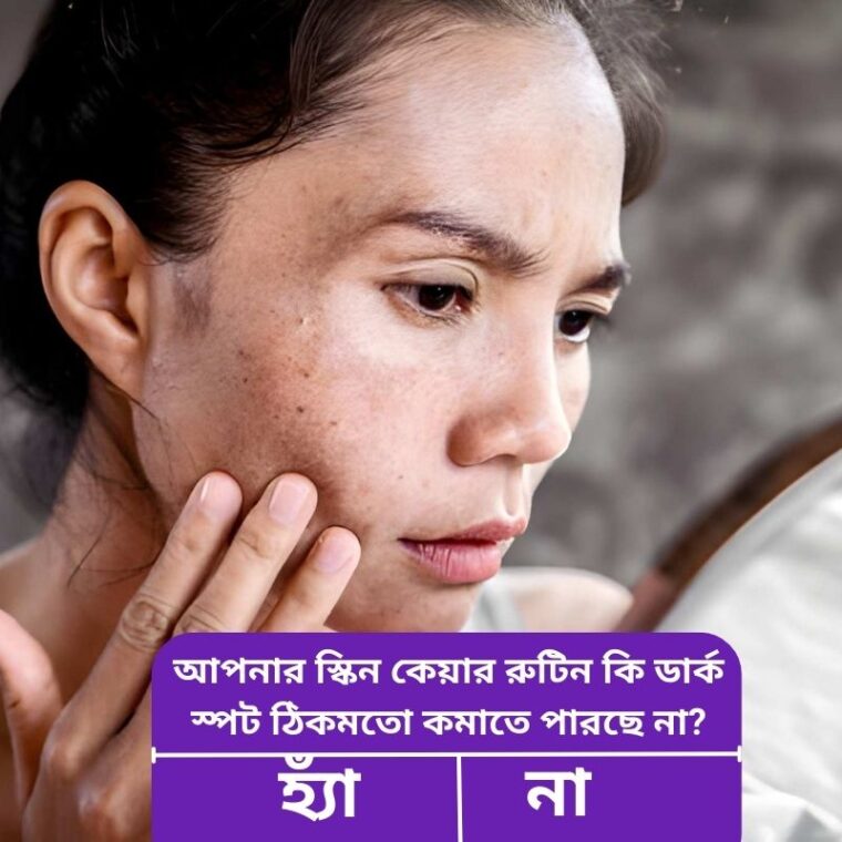 ডার্ক স্পট কমানোর উপায়: ঘরোয়া টিপস ও ট্রিটমেন্ট